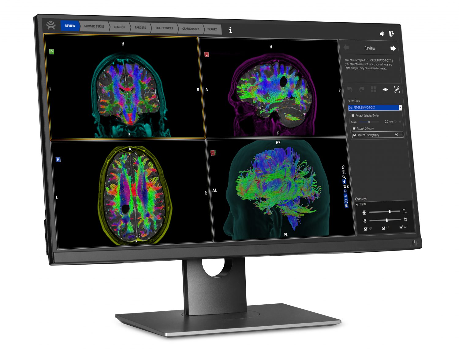 Plan Side View Synaptive Medical