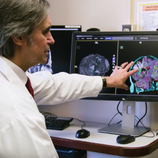 Brain Tumor Surgery with BrightMatter: A Patient’s Perspective